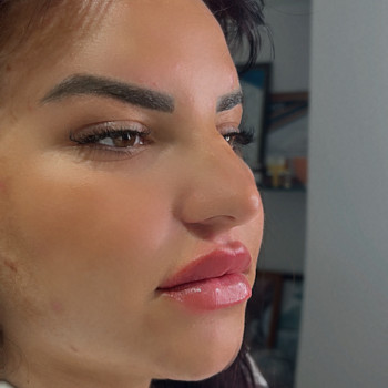 Фото з портфоліо косметолога Олена Савіна (Одеса)