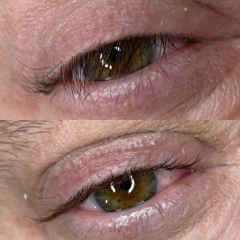 Чоловіче ламінування вій. 
Вирішення проблеми з трихіазом