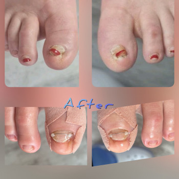   нігтів
  ногтей
 
  ніготь
  ноготь
 
 