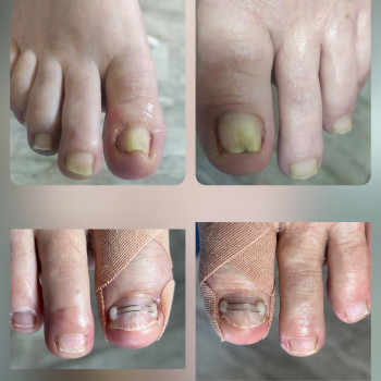   нігтів
  ногтей
 
  ніготь
  ноготь
 
 