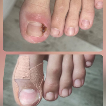   ніготь
  ноготь
 
 