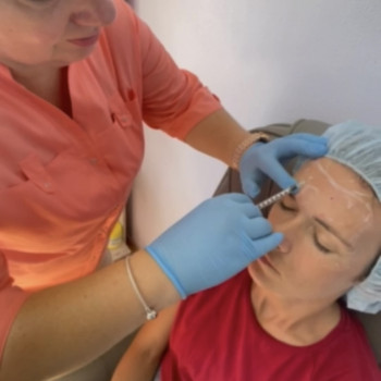 Ботулінотерапія
                    Косметолог Екатерина Житомир