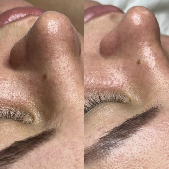 Катерина Онищук, Житомир Фото - 23