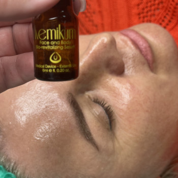 Пілінг біоревіталізант- так сяє шкіра після нього