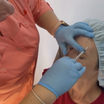 Ботулінотерапія