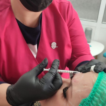 Ботулінотерапія