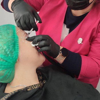 Ботулінотерапія