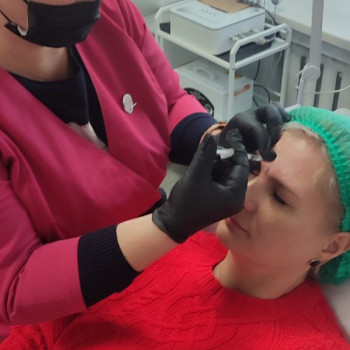 Ботулінотерапія