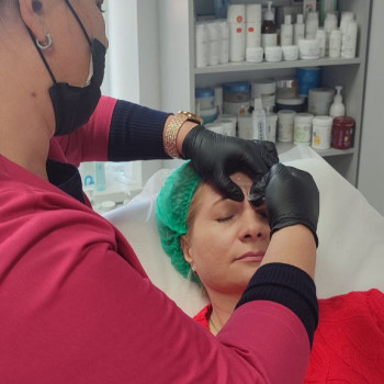 Ботулінотерапія