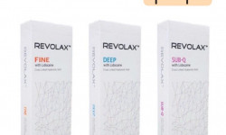 Аугментація Губ Салон краси Імперія краси Кременчук