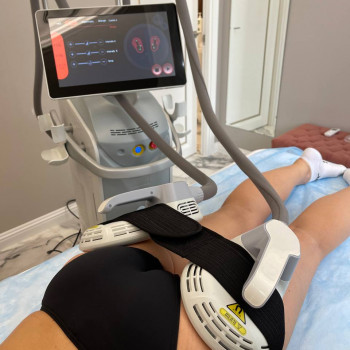 LPGClub, Київ Фото - 35