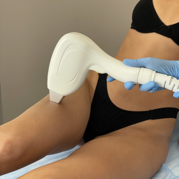 LPGClub, Київ Фото - 38