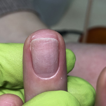 Апаратний манікюр
                    Мастер маникюра Анна Запорожье