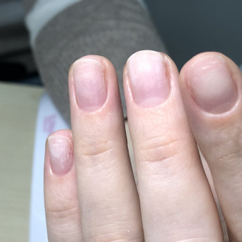 Апаратний манікюр
                    Мастер маникюра Анна Запорожье