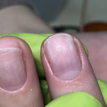 Апаратний манікюр
                    Мастер маникюра Анна Запорожье