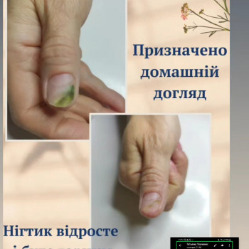 Тетяна Головко, Борисполь Фото - 10