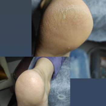 Тетяна Головко, Борисполь Фото - 15