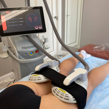 LPGClub, Київ Фото - 31