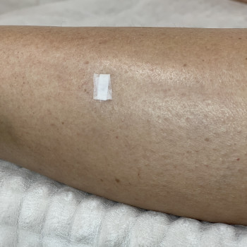 Обов’язково підготовка до проведення процедури.