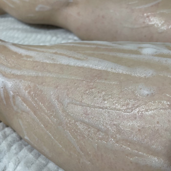 Відразу після процедури.