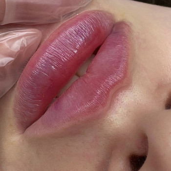 Контурная пластика губ
                    Мастер перманентного макияжа Лидия Измаил