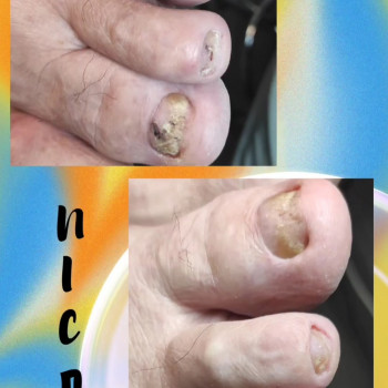 Центр подологии и тейпирования, Запорожье Фото - 2