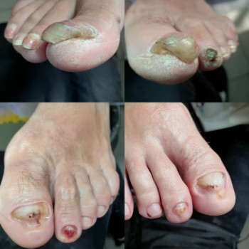 Центр подологии и тейпирования, Запорожье Фото - 41