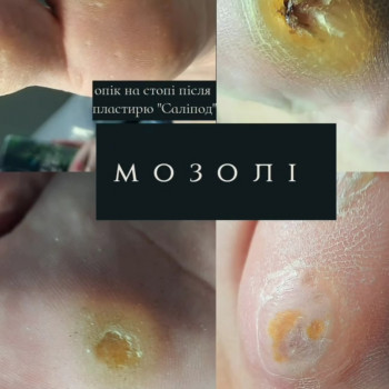 Центр подологии и тейпирования, Запорожье Фото - 42