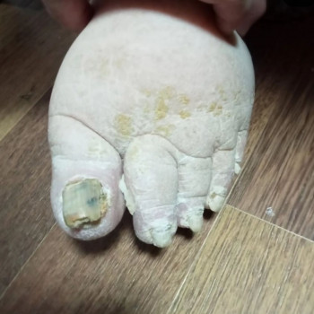 Центр подологии и тейпирования, Запорожье Фото - 43