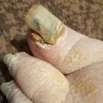 Центр подологии и тейпирования, Запорожье Фото - 44