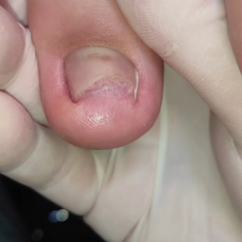 Центр подологии и тейпирования, Запорожье Фото - 46