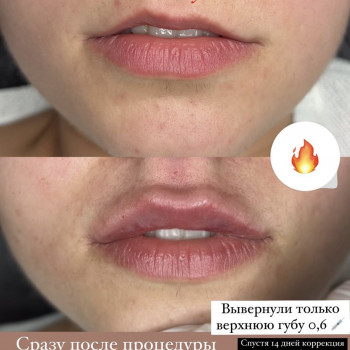 Лидия Терехова, Измаил Фото - 6