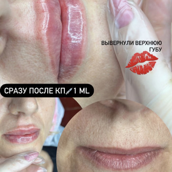 Лидия Терехова, Измаил Фото - 9