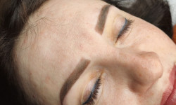 Видалення неякісного татуажу брів Майстер перманентного макіяжу Ксения Нетішин