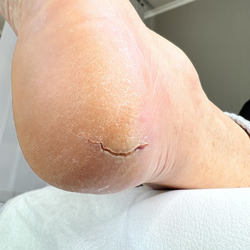 Фото до обробки.