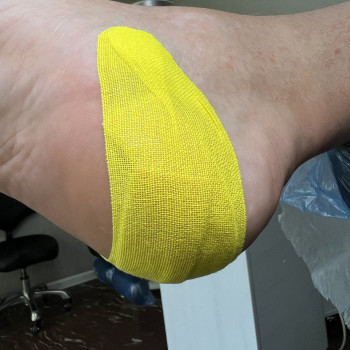 Розвантажуюча повʼязка