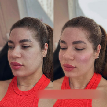 Марина Тенетюх, Тернопіль Фото - 6