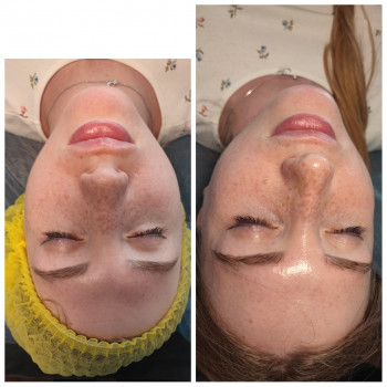 Людмила Нестеренко, Харків Фото - 3