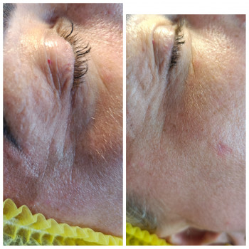 Людмила Нестеренко, Харків Фото - 9