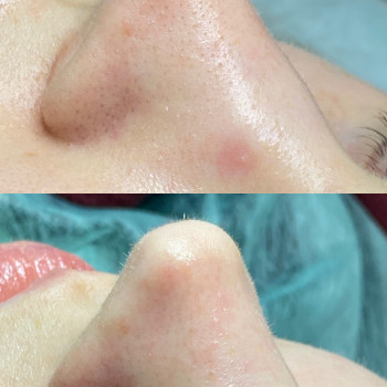 Аліна Лейченко, Рівне Фото - 10