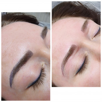 1 процедура