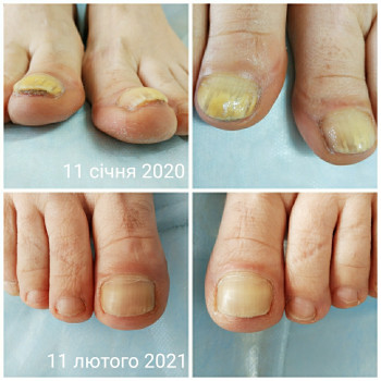 Альона Кравчук, Владимир-Волынский Фото - 5