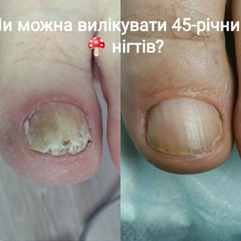 Альона Кравчук, Владимир-Волынский Фото - 7