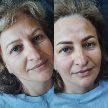 Ольга Розумна, Тернополь Фото - 15