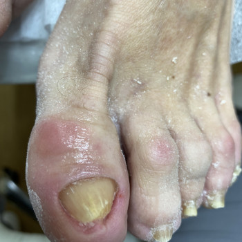 Результат за 6 місяців