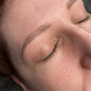 Загоєні бровки