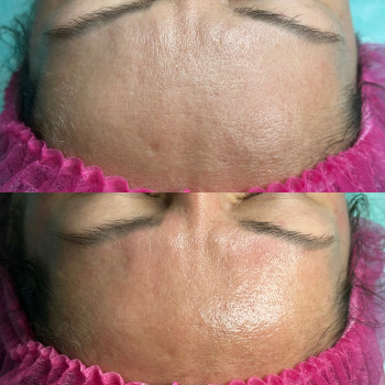 Руслана Мицней, Черновцы Фото - 100