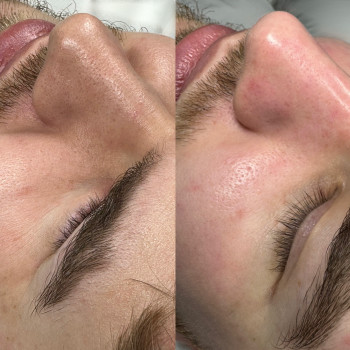 Руслана Мицней, Черновцы Фото - 99