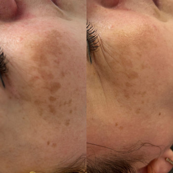 MCA innoaesthetics
                    Косметолог Маргарита Черкассы