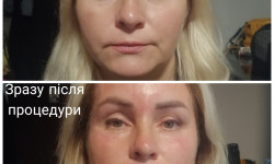 Масаж обличчя, шиї, декольте Косметолог-естетист Инна Миколаїв
